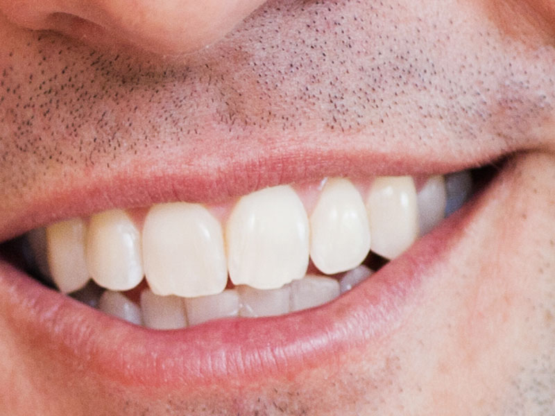 ?????????????????????????????????????????????????????????????????????????????????????????????????????????????????????????????????????????????????????????????????????????????????????????????????????????????????????????????????????????????????????????????????????????????????????????????????????????????????????